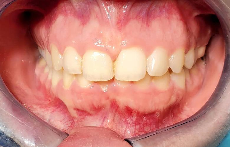 جراح دندانپزشک فلوشیب ایمپلنت از ICOIامریکا در تبریز